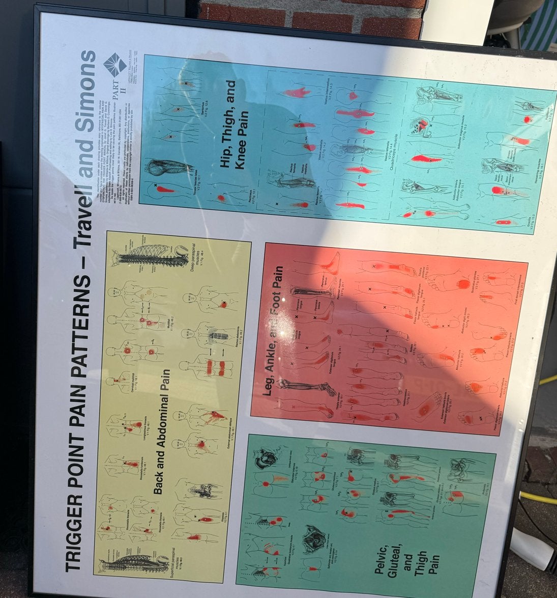 Anatomie posters Triggerpoint Pain Patterns & Anatomy Trains, Boeken, Ophalen, Zo goed als nieuw, Natuurwetenschap