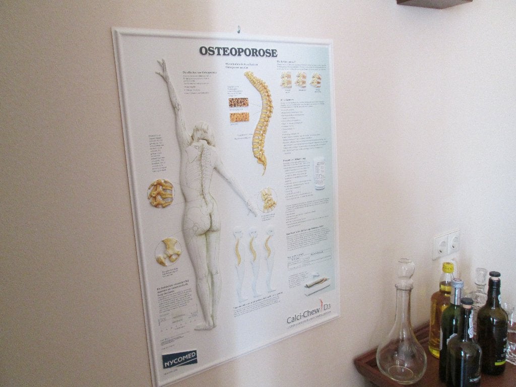 Anatomische Kaart Grafiek Osteoporose 54x74 cm 3 dimensional, Ophalen, Nieuw, Kunststof