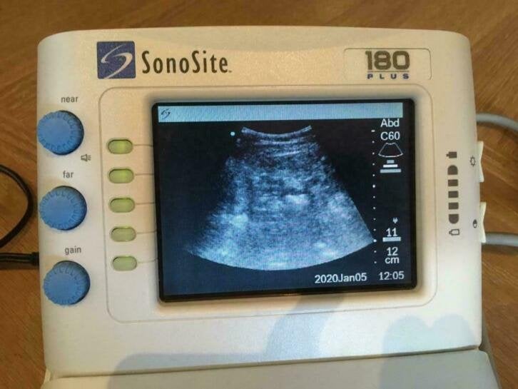 Complete echo set draagbaar Sonosite 180 plus in tas, Diversen, Niet ingevuld, Niet ingevuld, Ophalen of Verzenden, Zo goed als nieuw