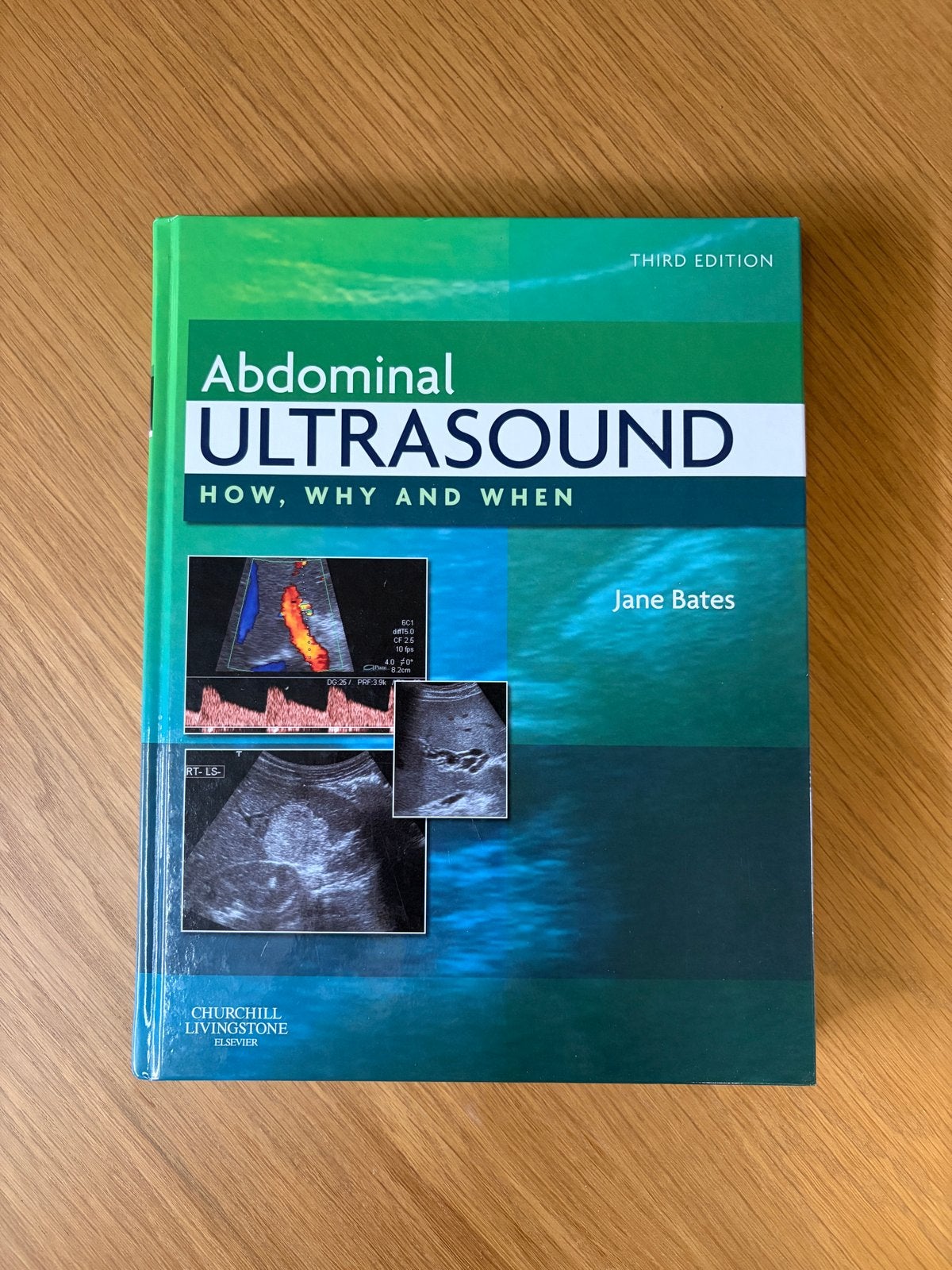 Abdominal Ultrasound: How, Why and When - Jane Bates, Boeken, Ophalen of Verzenden, Beta, Nieuw, HBO