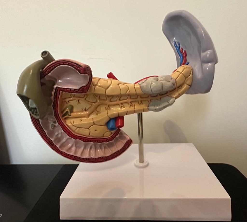 Anatomic pancreas, Ophalen, Zo goed als nieuw