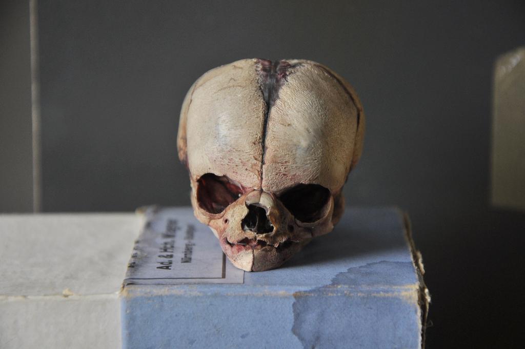 Human skull - fetus skull real medical specimen schedel mens, Verzamelen, Overige Verzamelen, Verzenden, Gebruikt