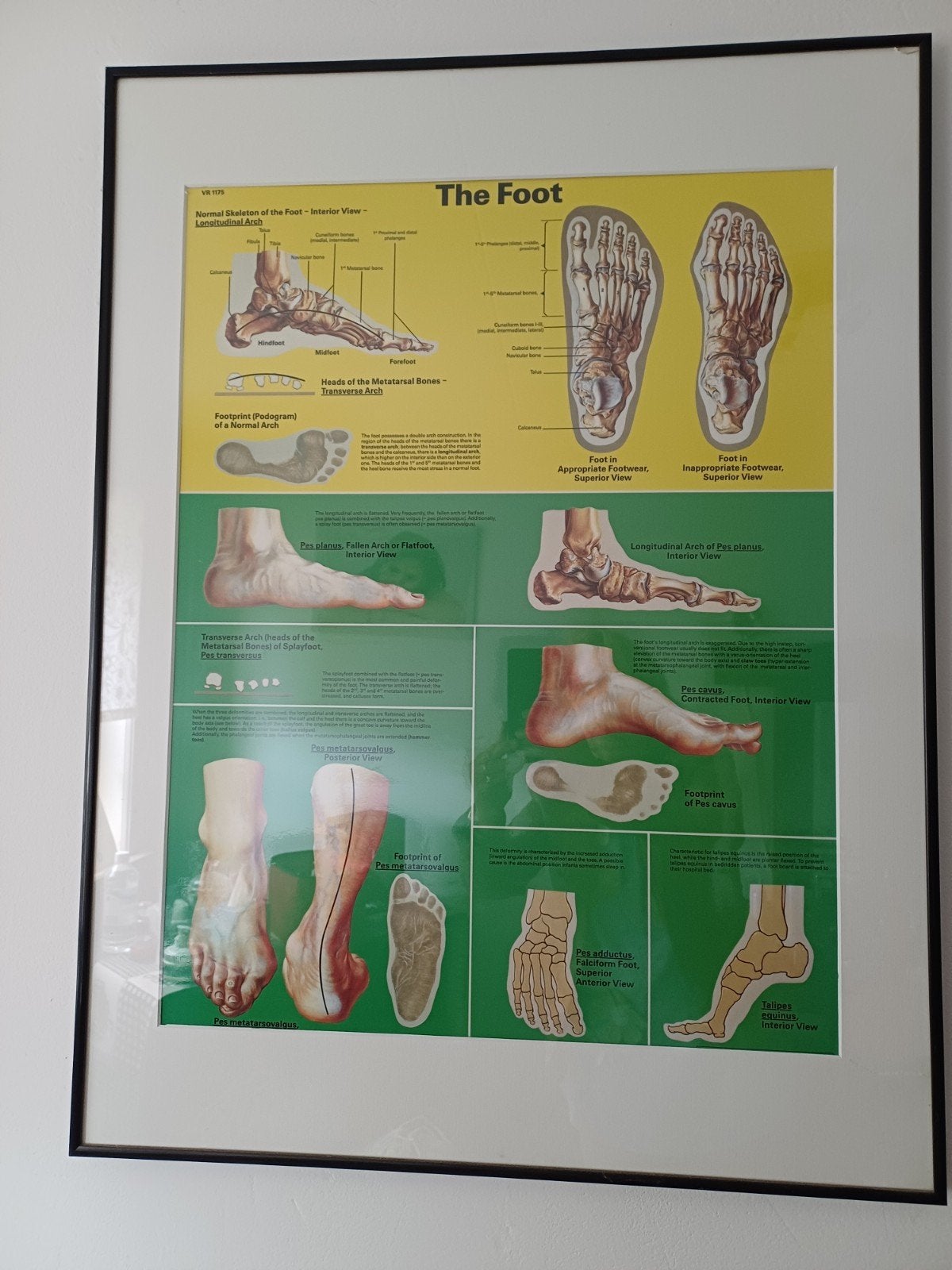 Anatomische poster 'The Foot' - Voetstructuren, Ophalen, 50 – 75, Gebruikt, Foto of Poster