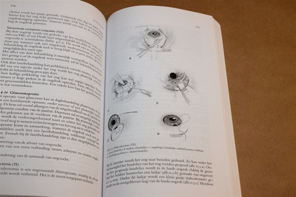 Inzicht in Zien — Inleiding Oogheelkunde, Boeken, Ophalen of Verzenden, Alpha, Gelezen, HBO