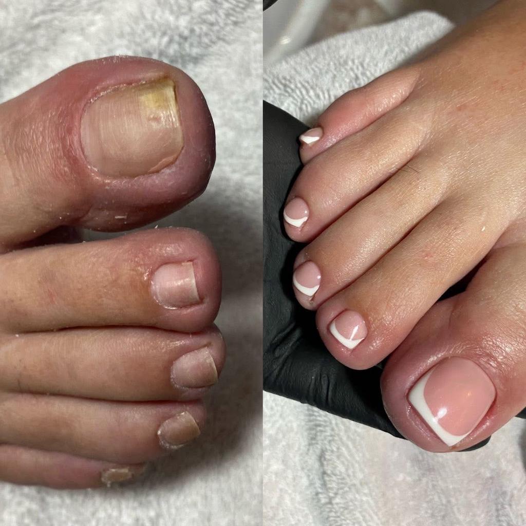 Russian Pedicure, Ophalen of Verzenden