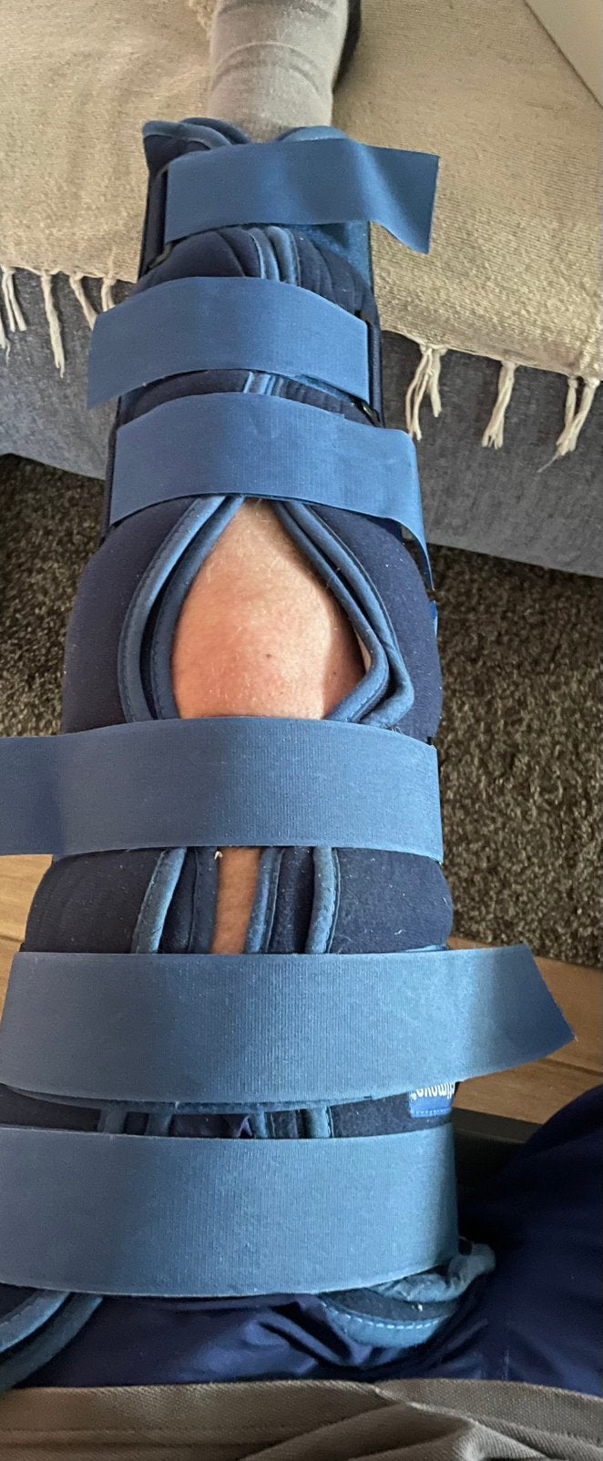 Knie Been brace. Gebruikt. Zie omschrijving., Diversen, Braces, Gebruikt, Ophalen