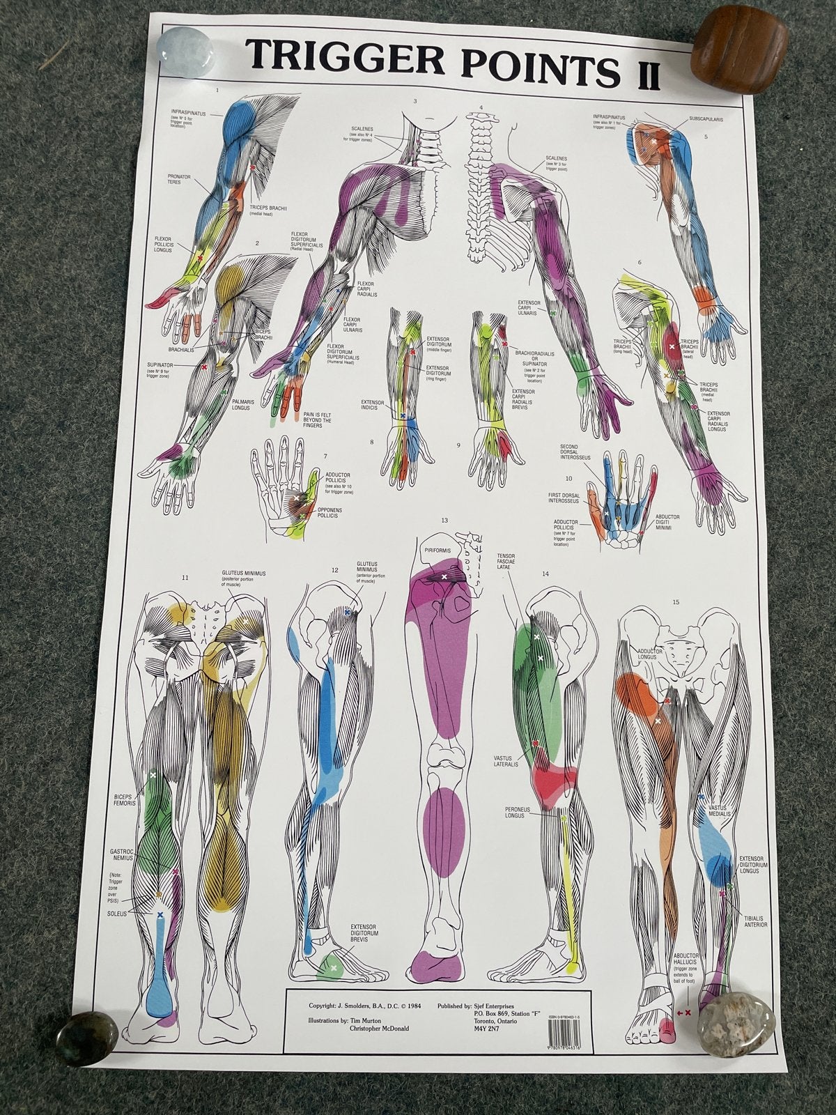 Anatomie Poster Triggerpoints II - Spieren en Pijngebieden, Ophalen, Gebruikt, Meerkleurig, Overige stijlen