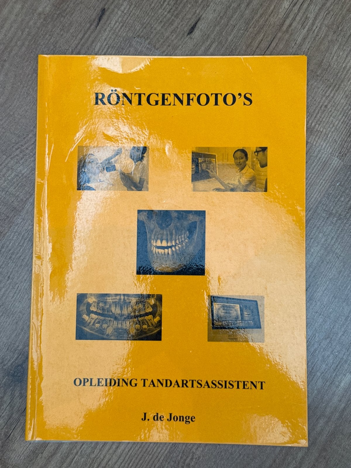 Röntgenfoto's Opleiding Tandartsassistent J. de Jonge, Ophalen of Verzenden, Beta, Zo goed als nieuw, MBO