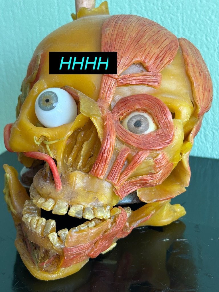 ANTIEK 19e EEUW ANATOMISCH WAX MENSEN SCHEDEL SKULL VAN WAS, Ophalen of Verzenden