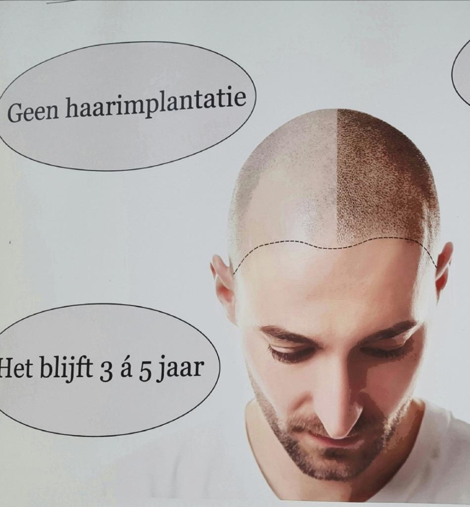 Mhp micro haar tatoeage/SC haargroei/PMU Permanent Make up, Diensten en Vakmensen