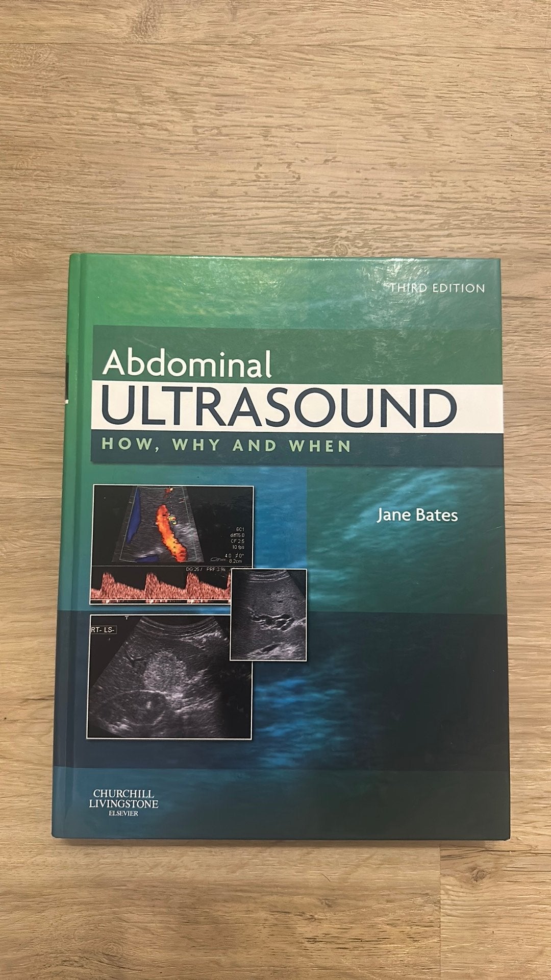 Abdominal ultrasound studieboek MBRT/echografie, Boeken, Ophalen of Verzenden, Gelezen
