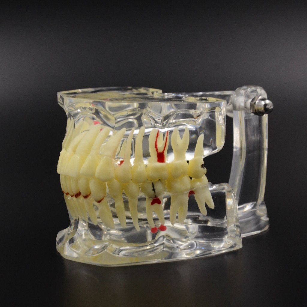 Gebit Menselijk Anatomie Model / Medisch Tandarts Mond Kies, Diversen, Verzenden, Nieuw