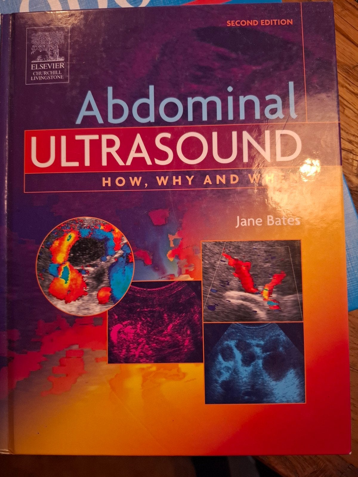 Abdominal Ultrasound: How, Why and When - Jane Bates, Boeken, Jane Bates, HBO, Beta, Ophalen
