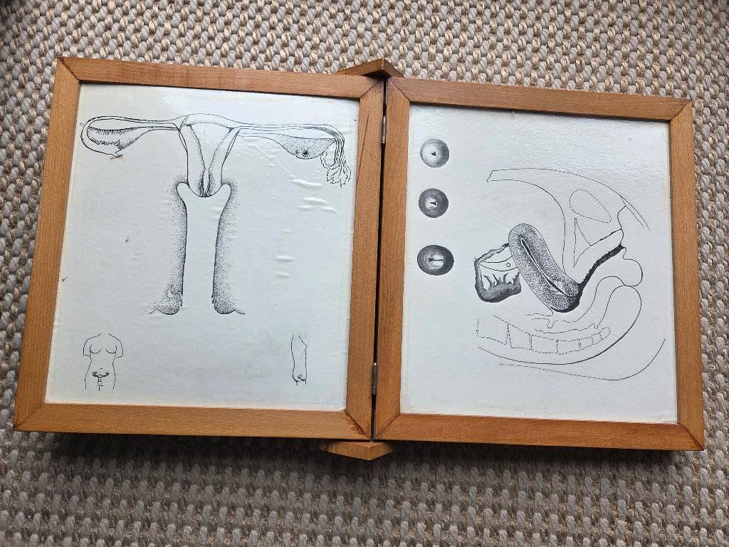 6 gyneacologische instructie platen, Antiek en Kunst, Ophalen of Verzenden