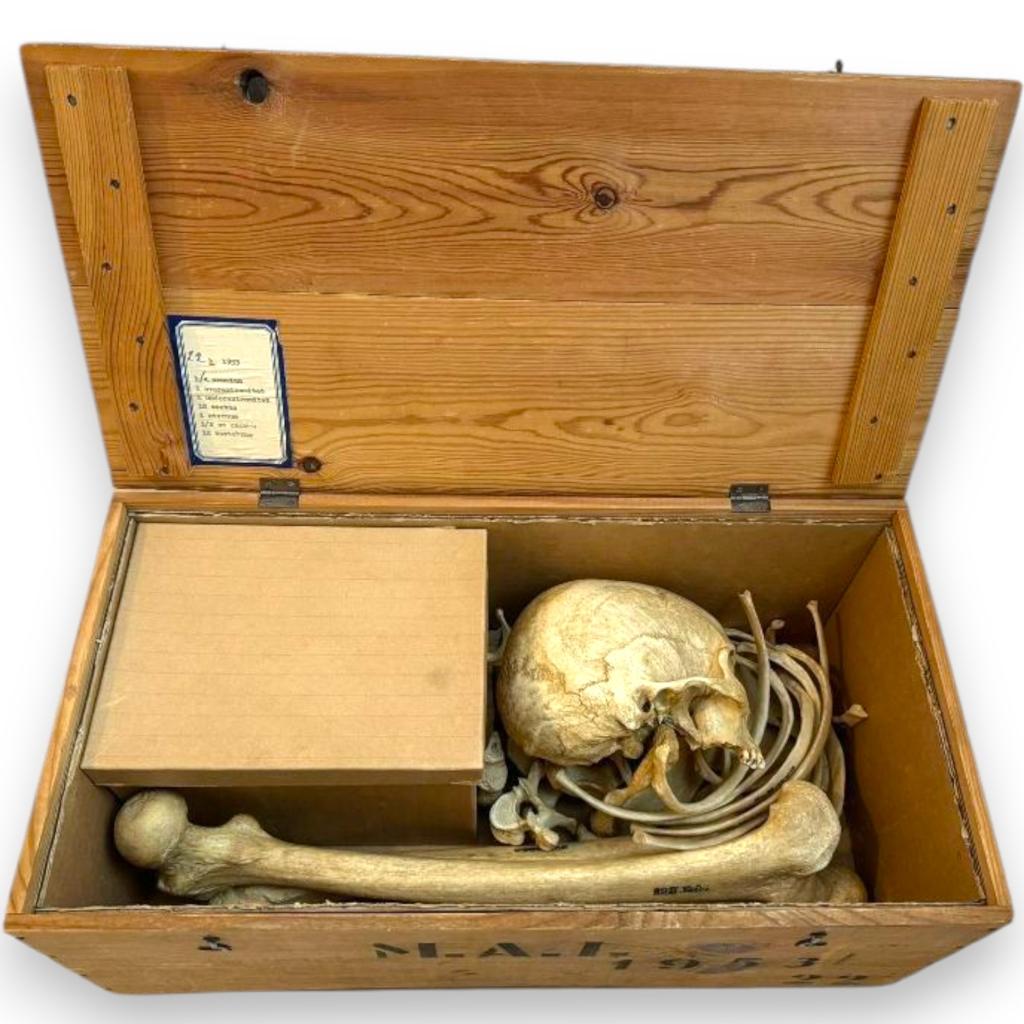 Antieke kist met medische skelet mens. Opgezette, Ophalen of Verzenden, Nieuw, Opgezet dier