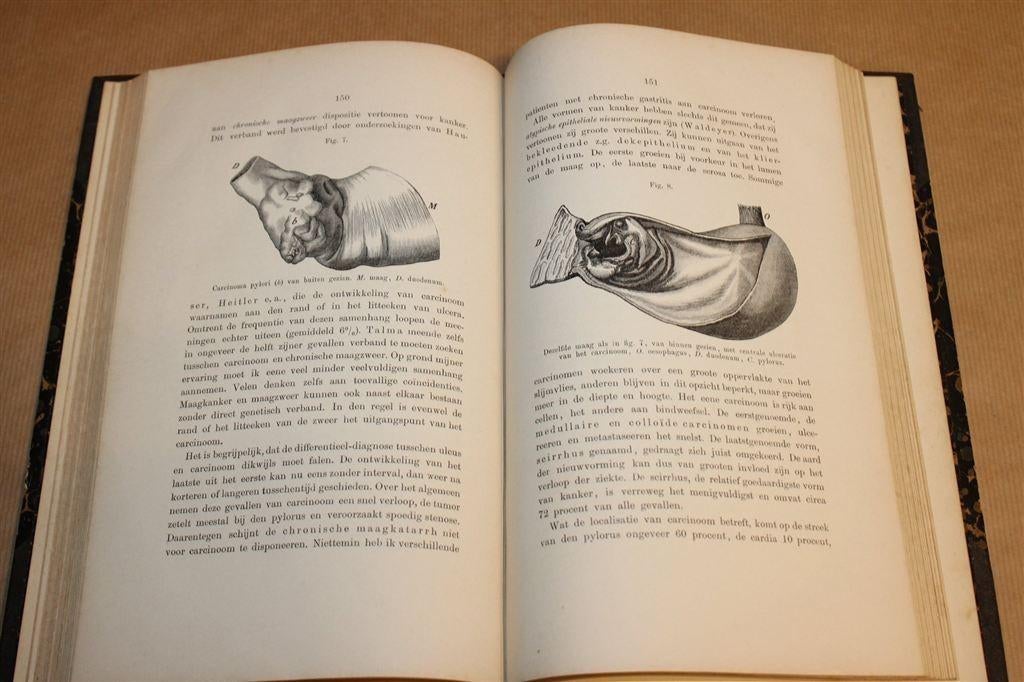 De Ziekten van de Maag — Klassiek Medisch Werk [1904], Ophalen of Verzenden