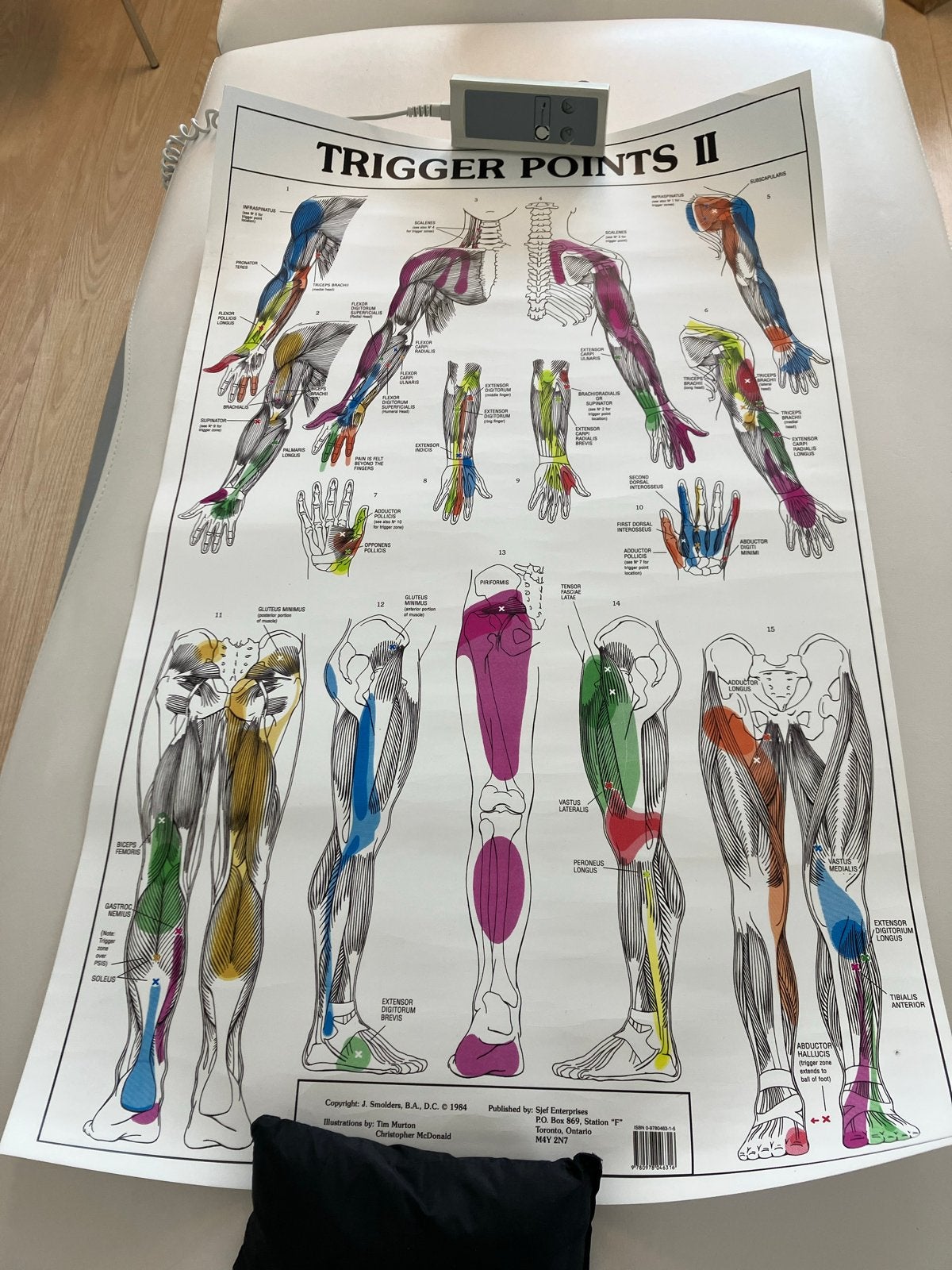 Trigger Points II Anatomische Poster - Spierpijn Referentie, Ophalen of Verzenden, Zo goed als nieuw