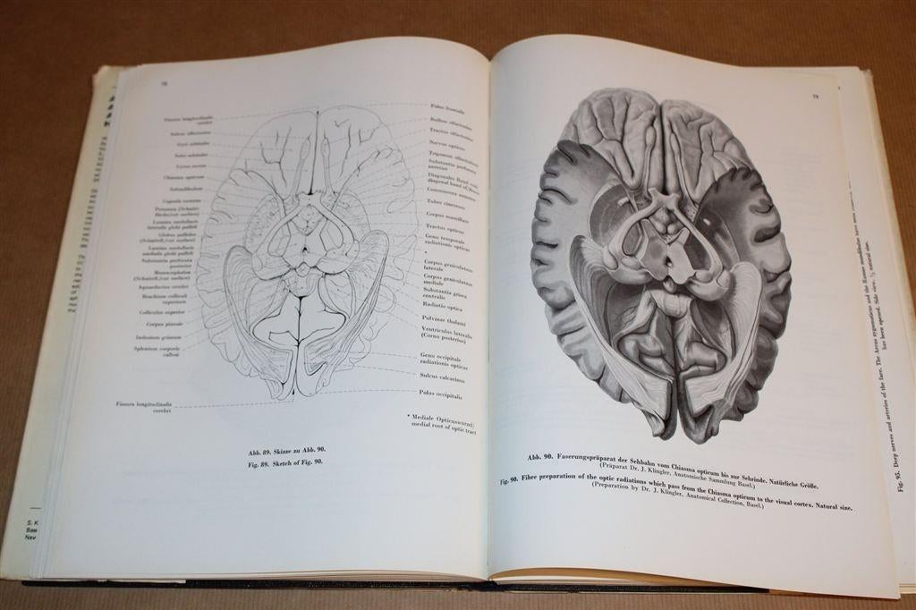 Vintage Anatomische Atlas [1972] — Zenuw- & Vaatstelsel, Ophalen of Verzenden, Gelezen, Natuurwetenschap