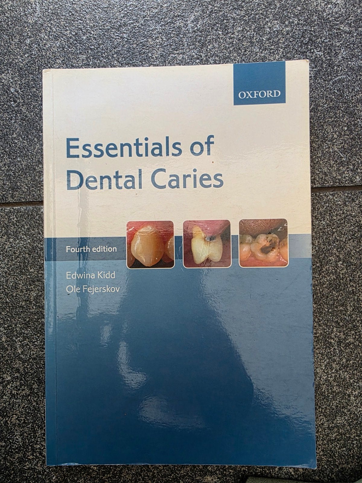 Essentials of Dental Caries - 4e editie, Boeken, Edwina Kidd, Ole Fejerskov, Ophalen of Verzenden, Beta, WO