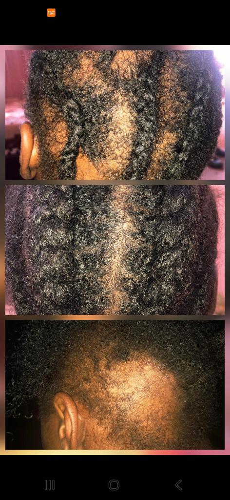 Innohair Organic hair Growth, Ophalen of Verzenden, Nieuw, Haarverzorger of -hersteller