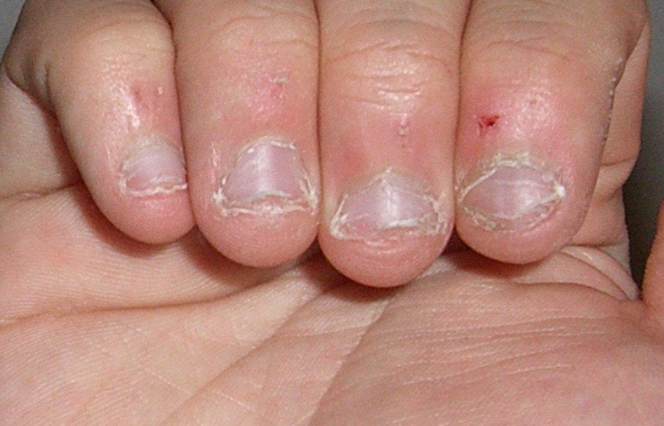MODEL NAGELBIJTER GEZOCHT, Ophalen of Verzenden, Nieuw, Overige kleuren, Handen en Nagels
