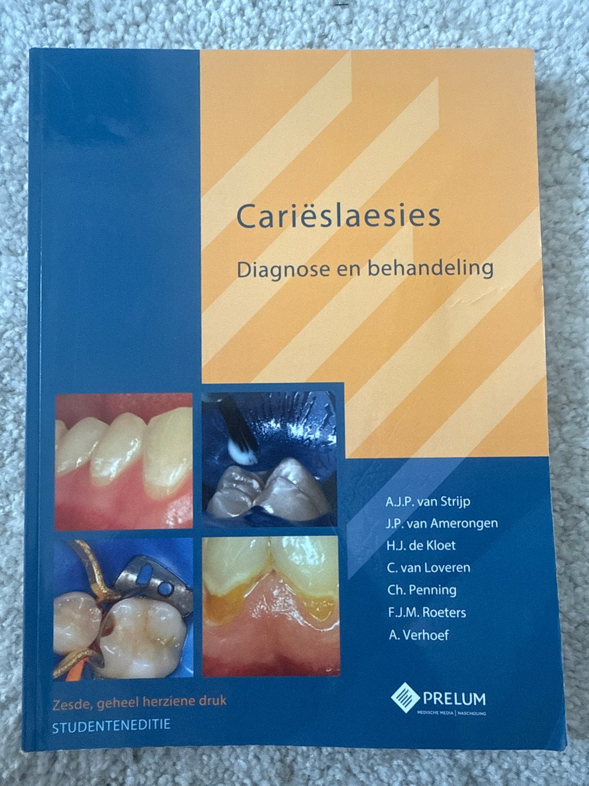 Cariëslaesies: Diagnose en behandeling (STUDENTENEDITIE), Ophalen of Verzenden, Beta, Zo goed als nieuw, HBO