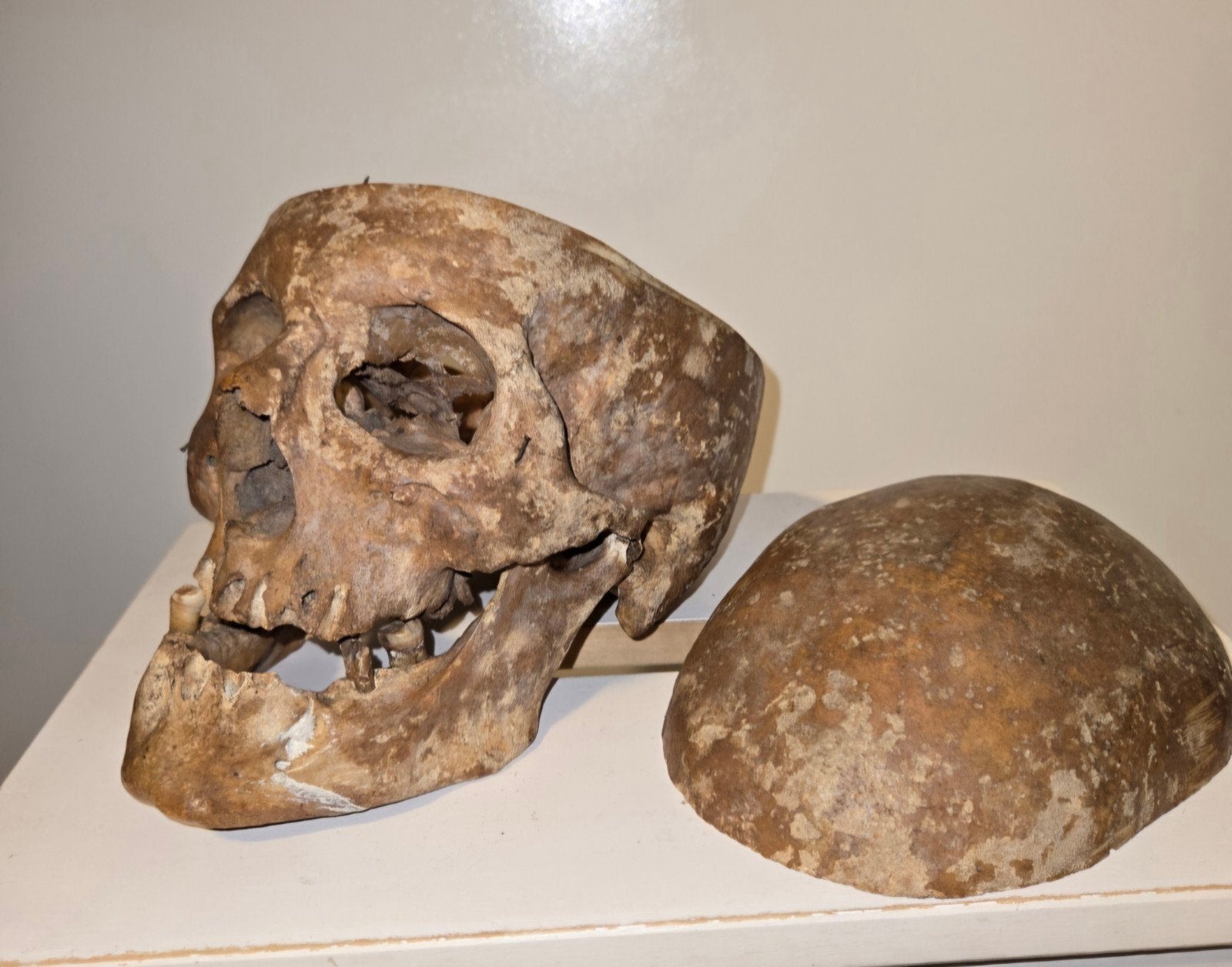 Anatomische mens schedel  -Studie of Educatieve doeleinden, Ophalen of Verzenden