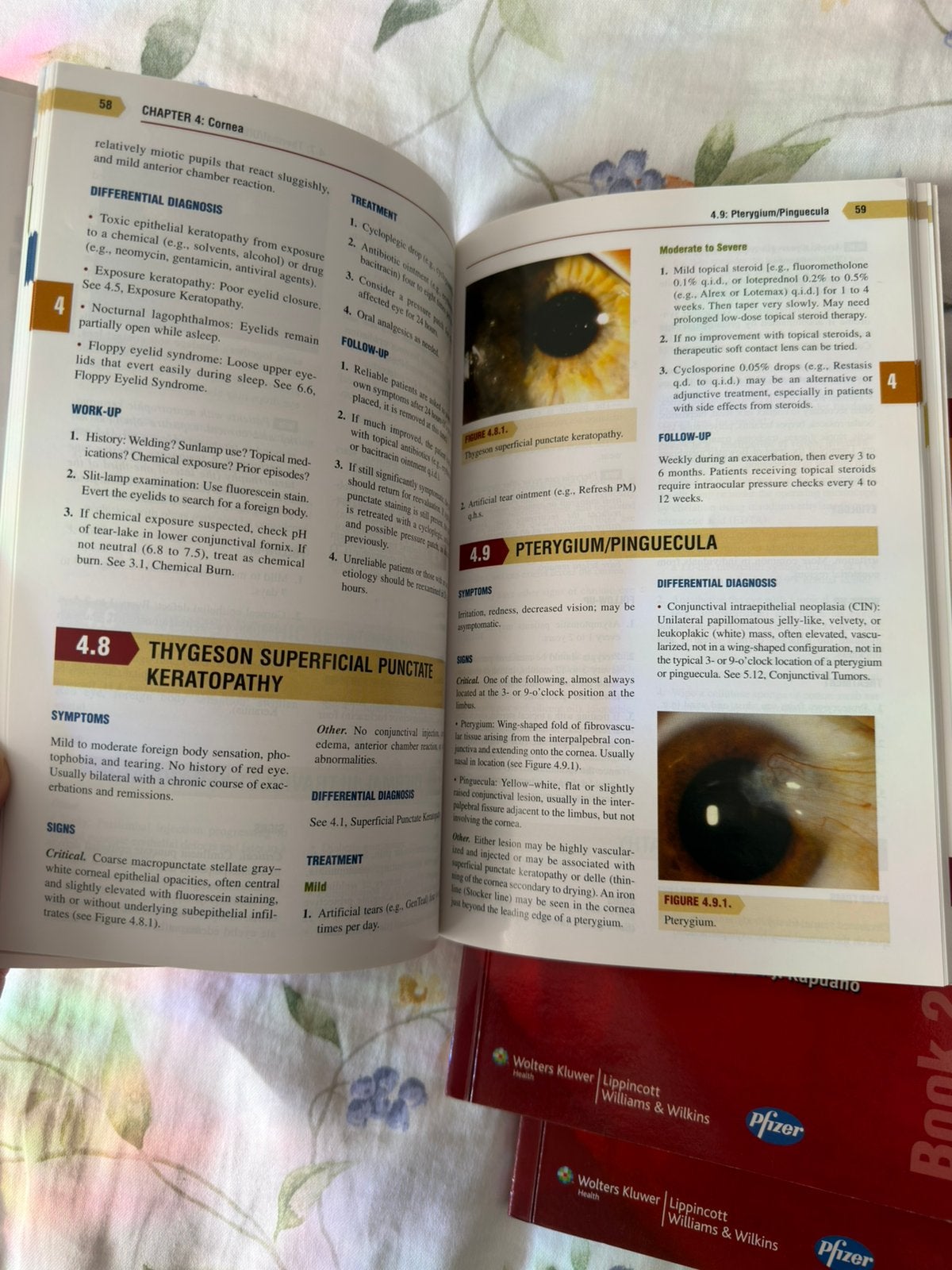 Kanski (testyourself), Wills Eye Manual1-2-3, Ocular Allergy, Boeken, Ophalen, Beta, Zo goed als nieuw, WO