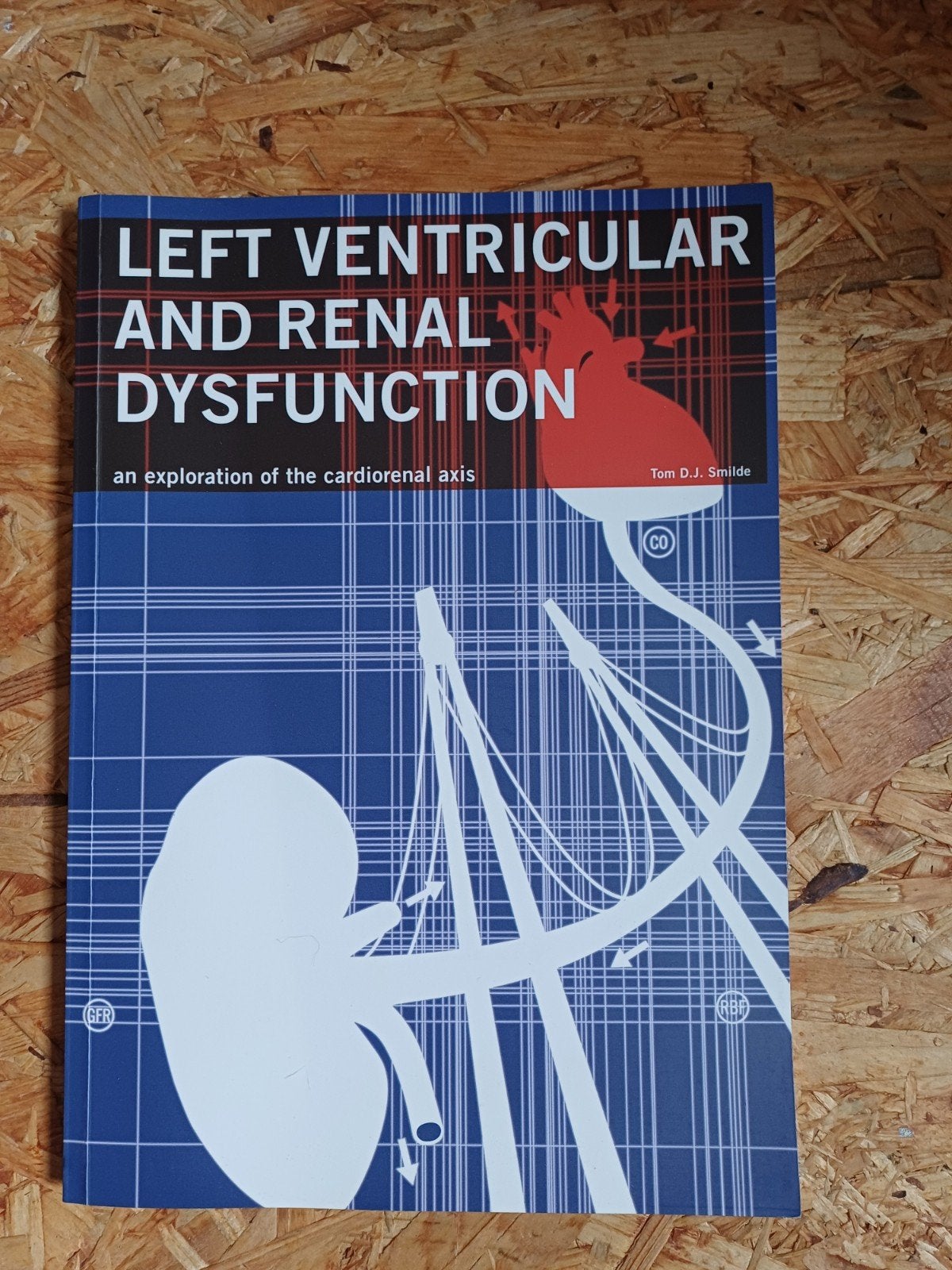 Left Ventricular and Renal Dysfunction - Tom D.J. Smilde, Ophalen of Verzenden, Beta, WO, Tom D.J. Smilde