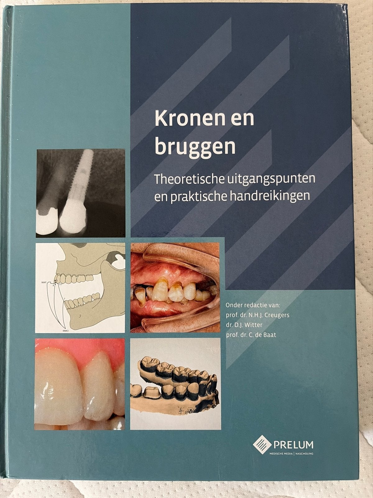 KRONEN EN BRUGGEN - Tandheelkunde, Ophalen of Verzenden, Beta, Zo goed als nieuw, WO