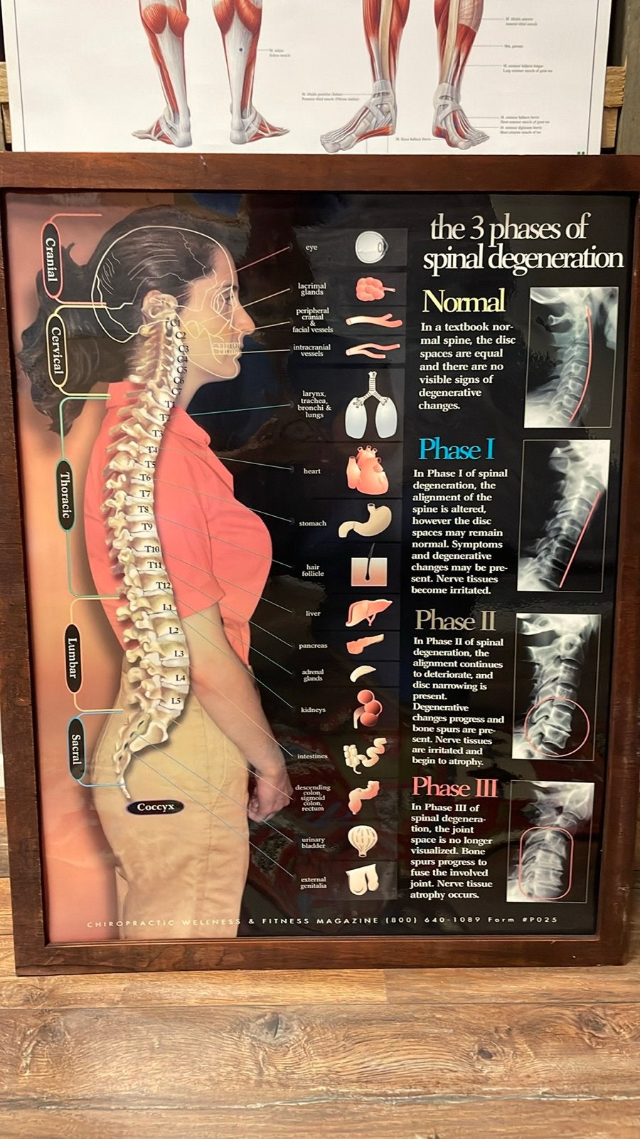 Anatomische poster: Wervelkolom en organen, Ophalen of Verzenden, Gebruikt, Meerkleurig, Hout