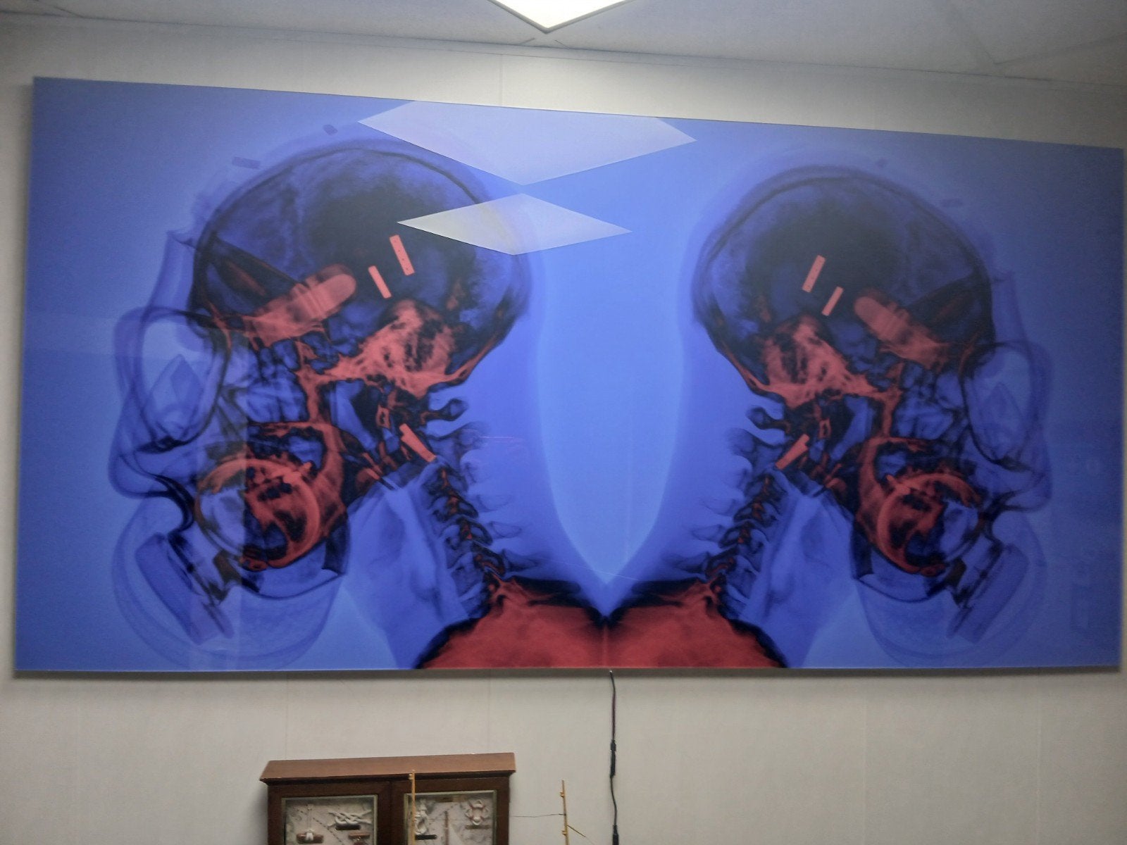 Groot Plexiglas Schilderij 1.00x2.00m - Medische X-ray Kunst, Ophalen