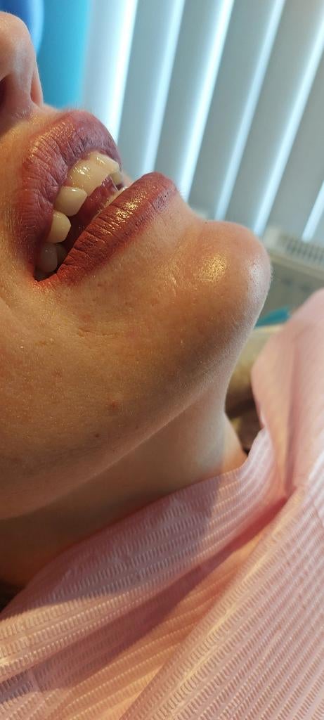 BB LIPS, Ophalen of Verzenden, Nieuw, Lipbalsem