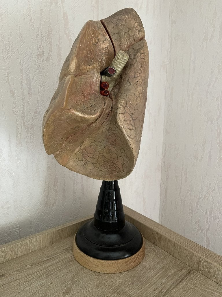 Antiek anatomisch van long uit Duitsland - longziekten, Antiek en Kunst, Ophalen of Verzenden