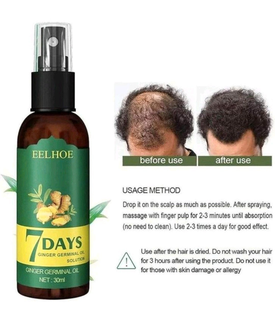 Jaysung haargroei spray. Voor dikker en voller haar, Ophalen of Verzenden, Nieuw, Haarverzorger of -hersteller