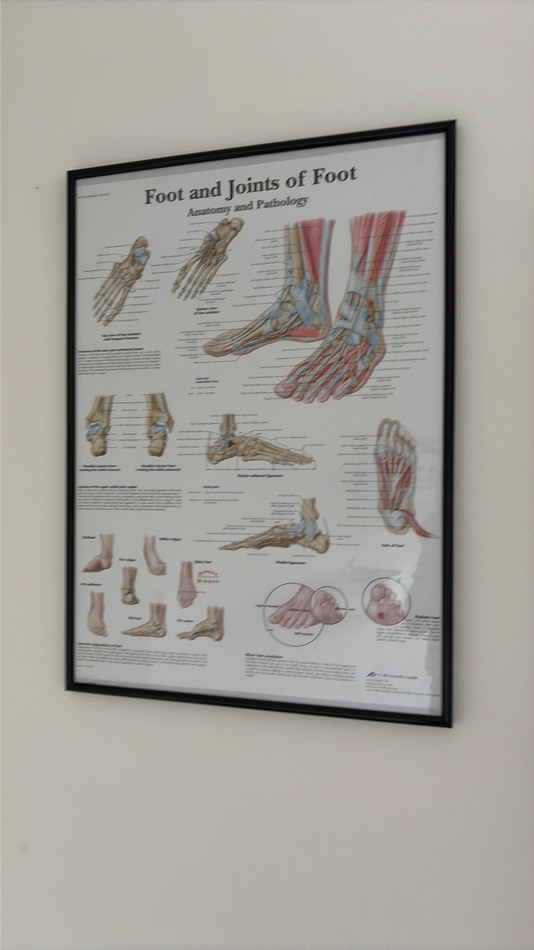 Poster voor in een behandelkamer, Ophalen, Zo goed als nieuw, A1 t/m A3