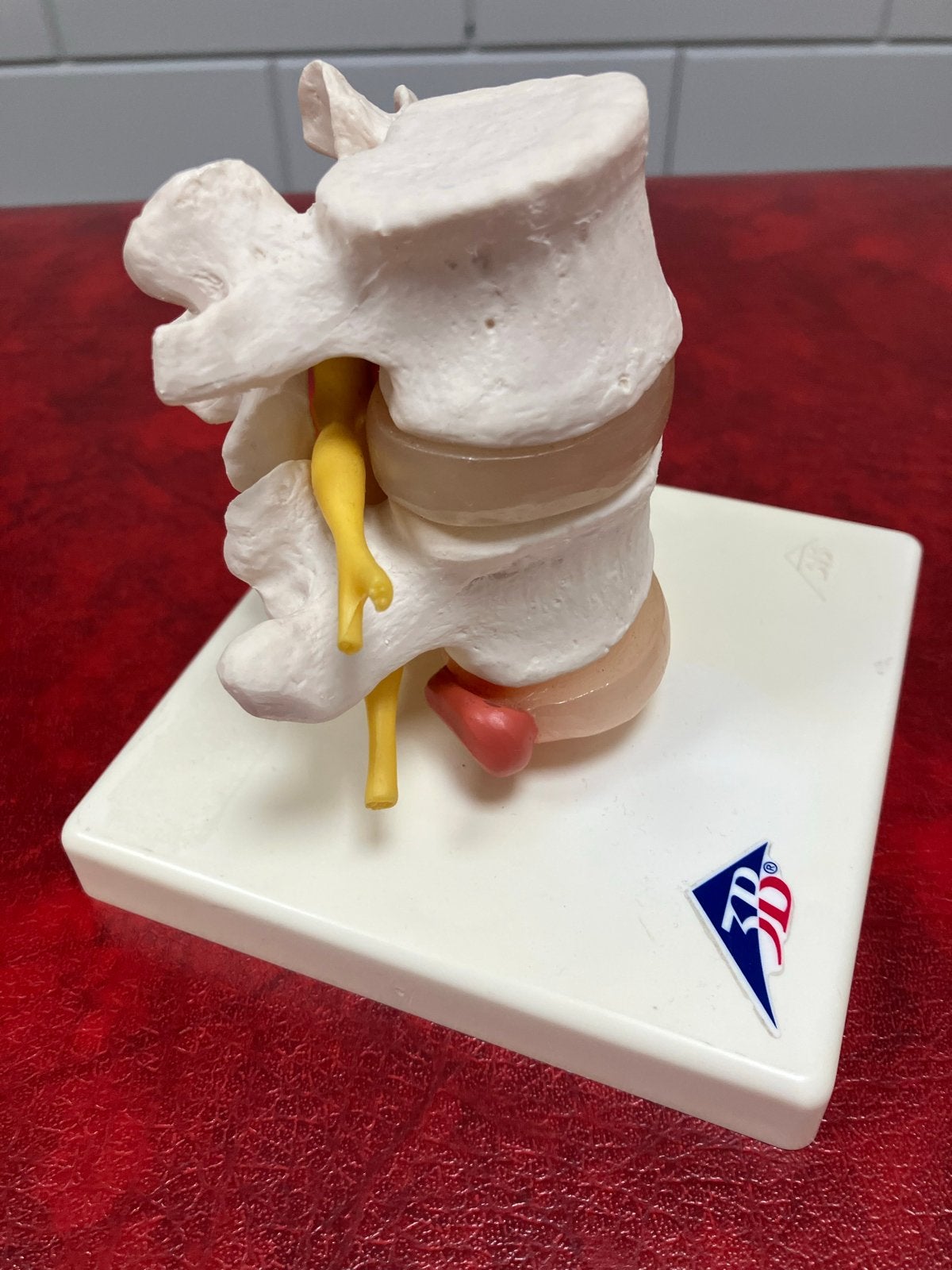Anatomisch model lage rug wervels met hernia, Ophalen of Verzenden, Gebruikt