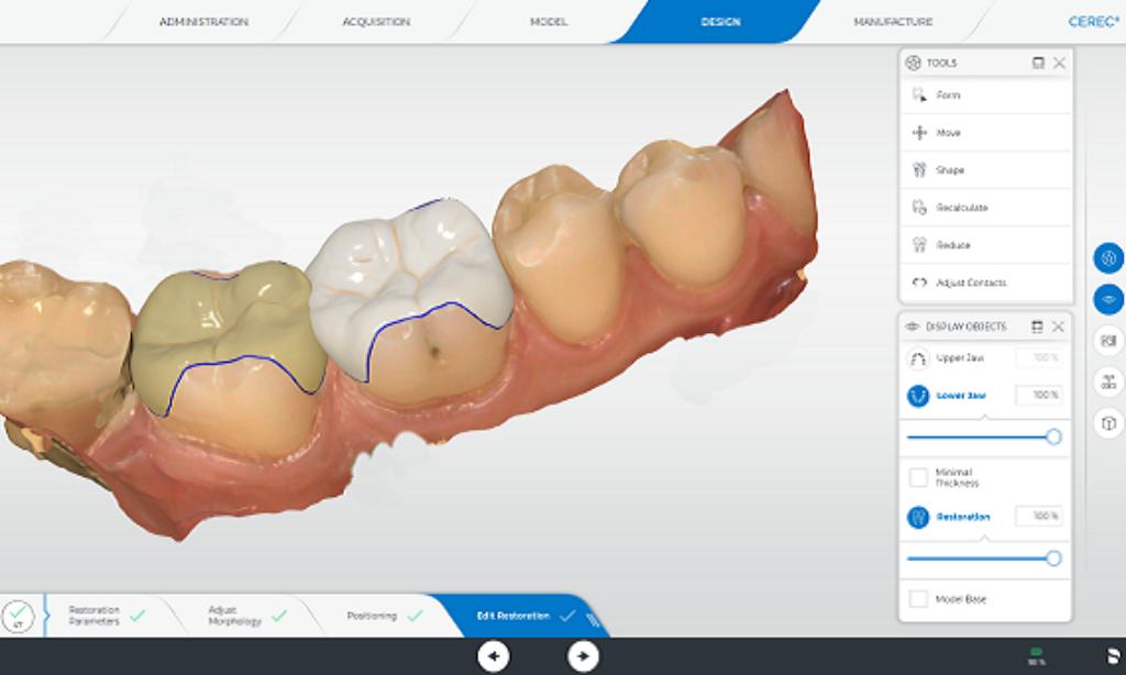Sirona Cerec 5.2 volledige versie, Ophalen, Nieuw