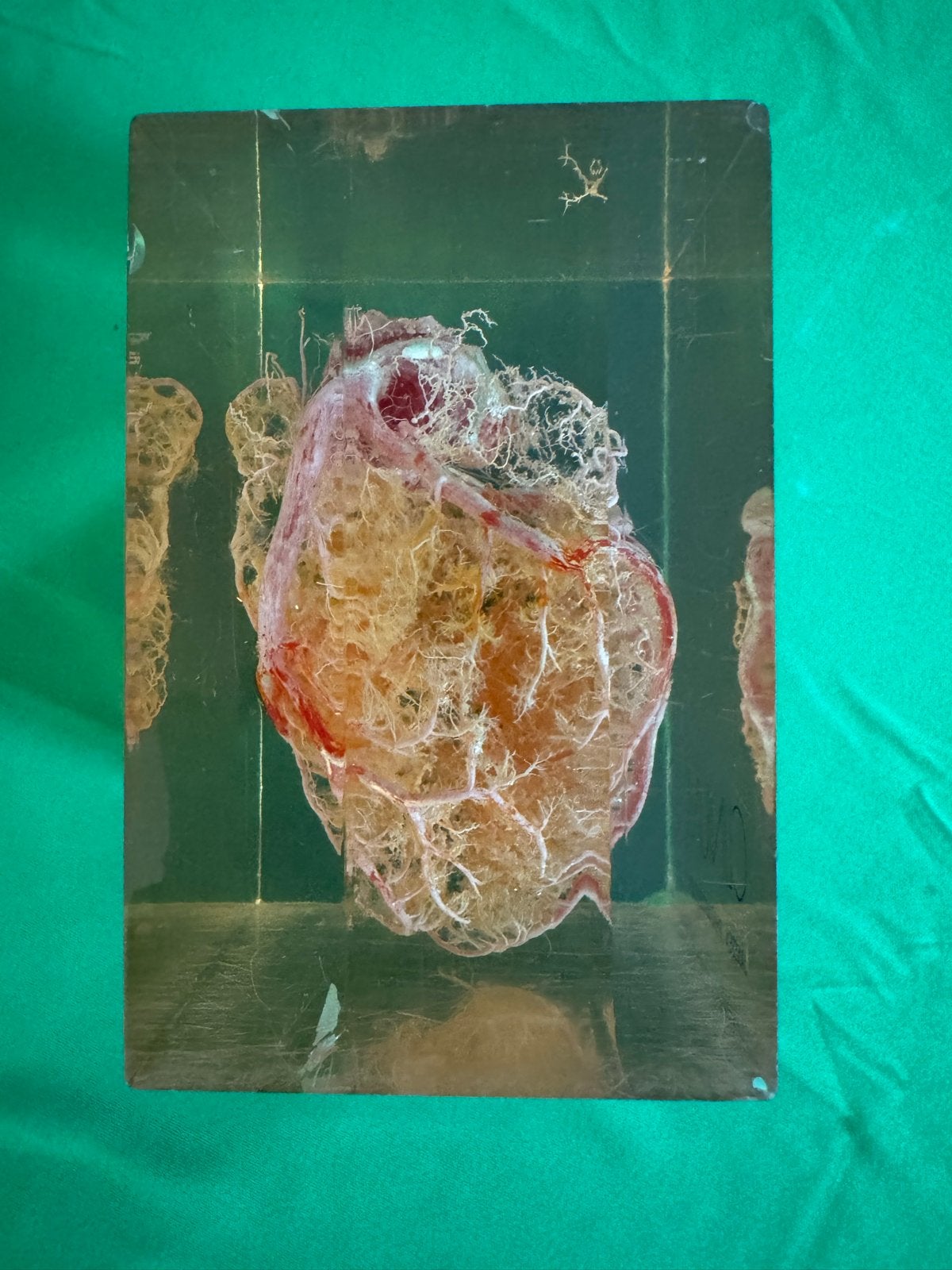 Menselijk hart in hars , Vintage Anatomisch Model, Ophalen