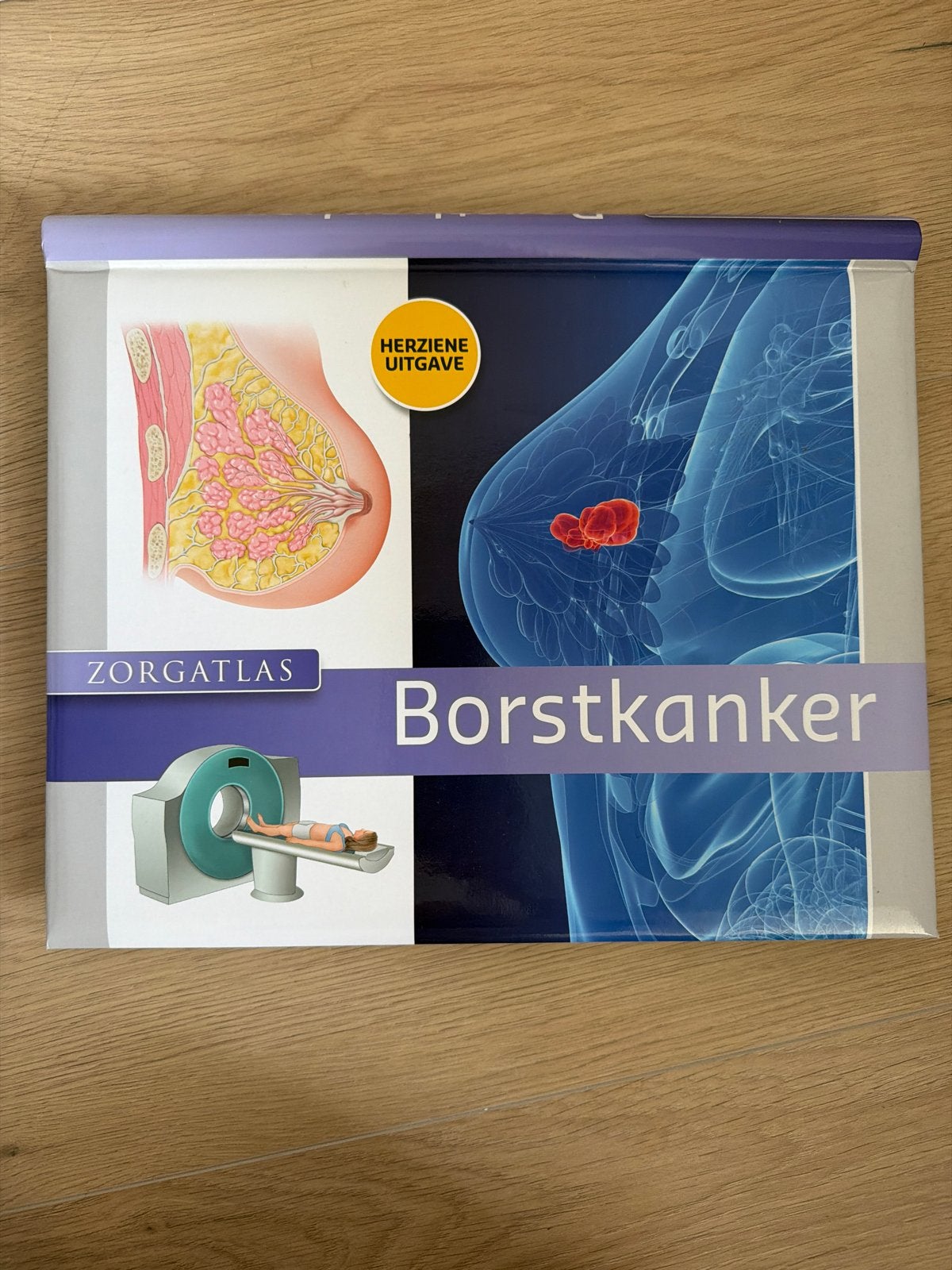 Zorgatlas Borstkanker - Herzien Uitgave - Nieuw Boek, Ophalen of Verzenden, Nieuw, Ziekte en Allergie