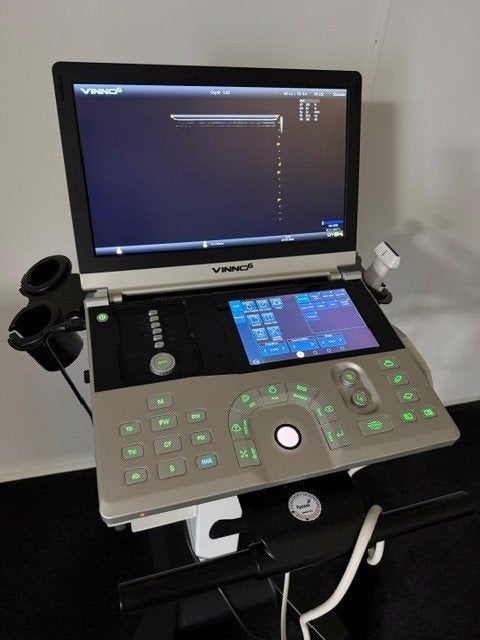 Vinno 6 Echografie mobiel systeem incl. lineair probe, Ophalen, Gebruikt