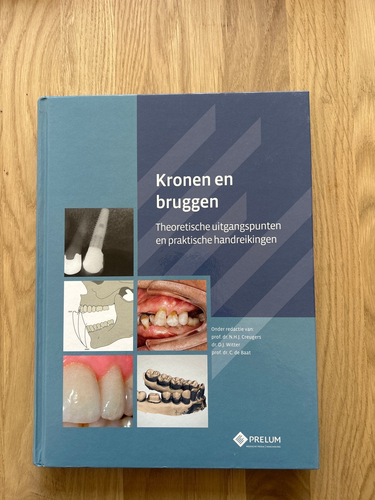 Kronen en bruggen: Theoretische uitgangspunten, Boeken, Ophalen of Verzenden, Beta, Zo goed als nieuw, HBO