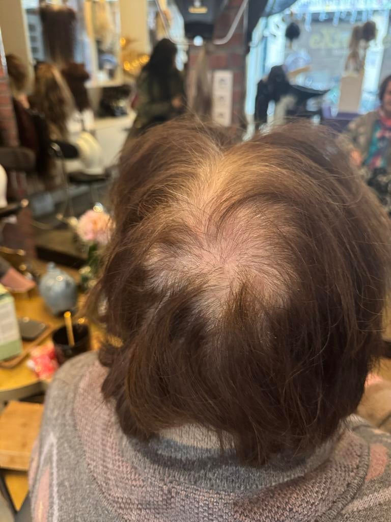 Haarstukken en haarwerken van echt haar - tegen haarverlies, Ophalen of Verzenden, Nieuw, Pruik of Haarverlenging