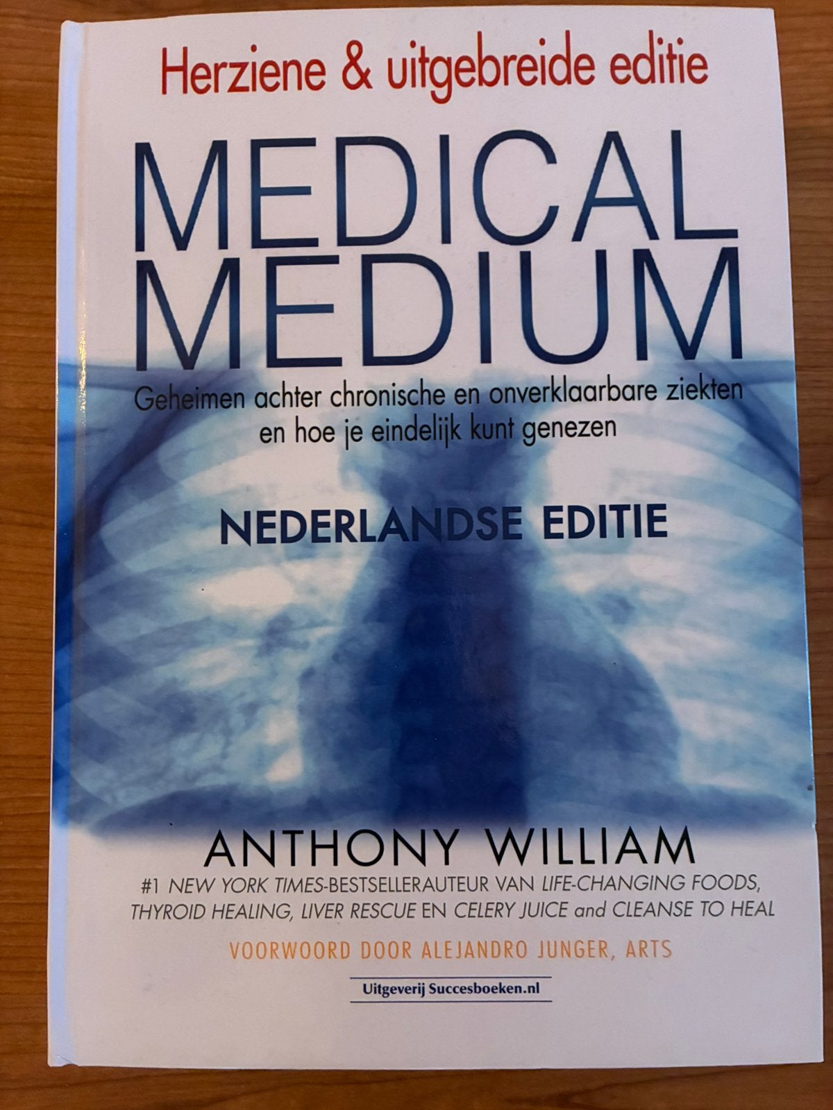 Medical medium, Ophalen, Zo goed als nieuw