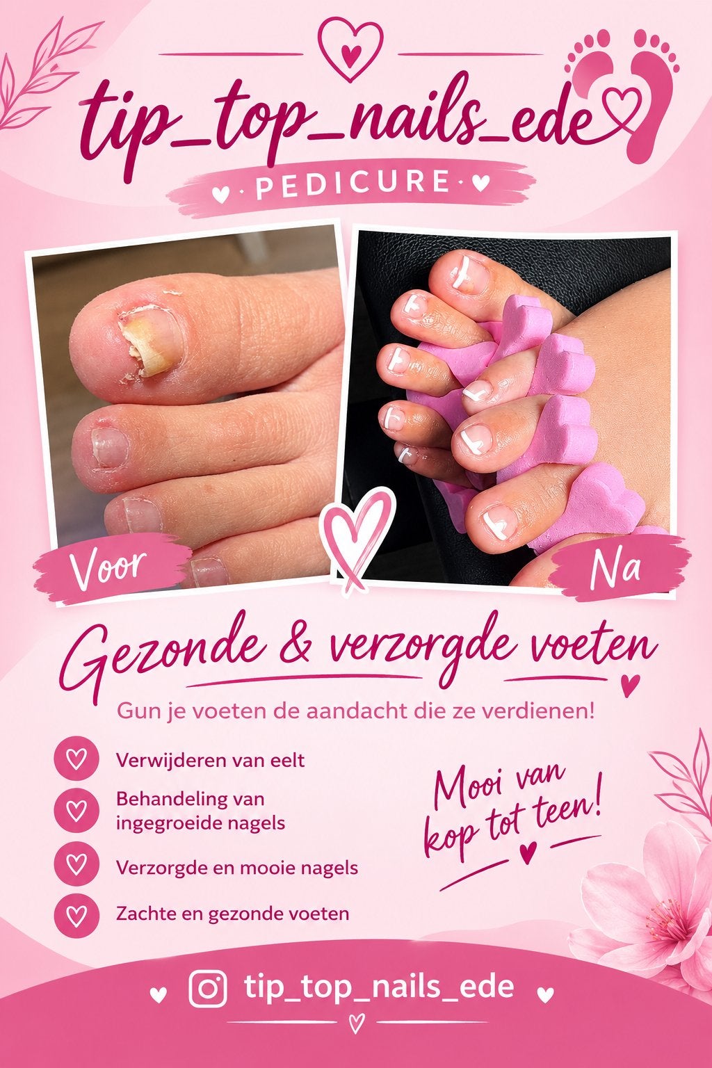 Pedicure ede, Ophalen, Nieuw, Overige typen