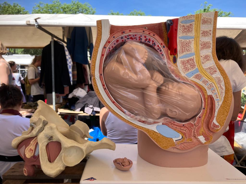 Anatomische modellen baarmoeder en bekken, Ophalen