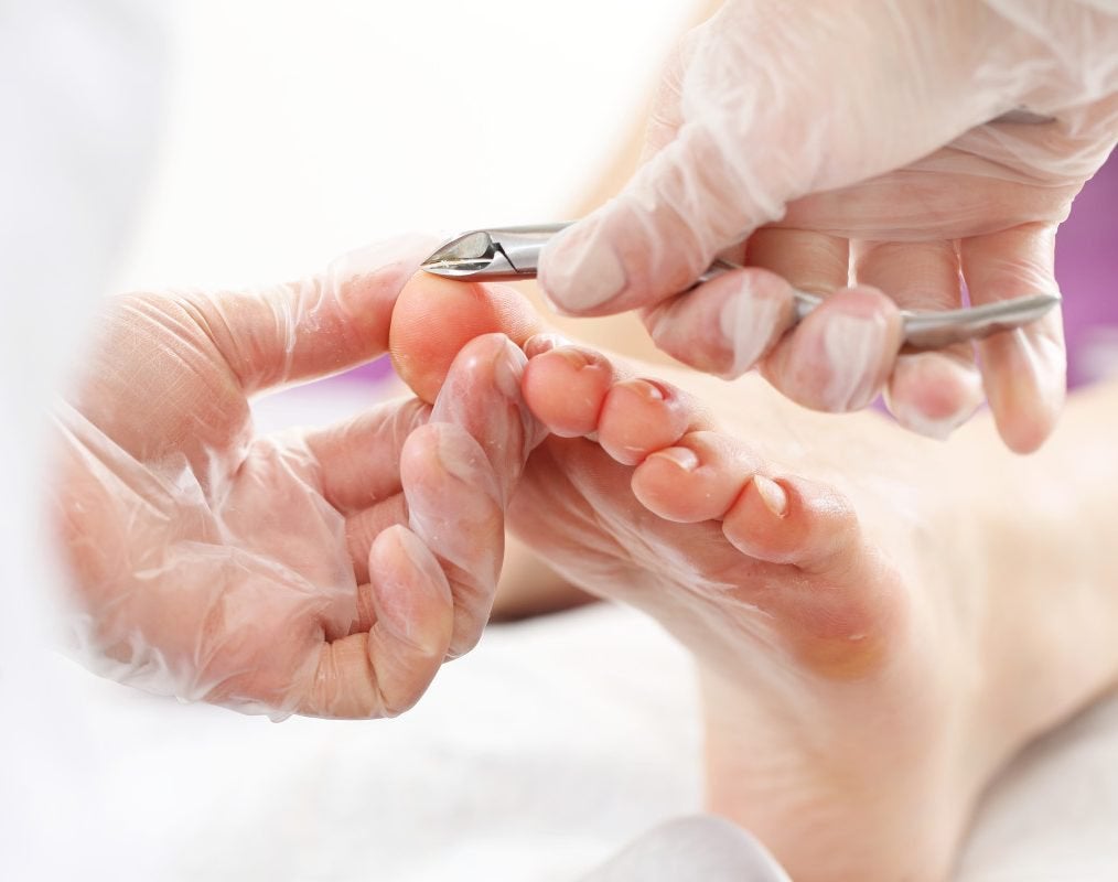 Medische pedicure aan huis, Komt aan huis, Nagels lakken