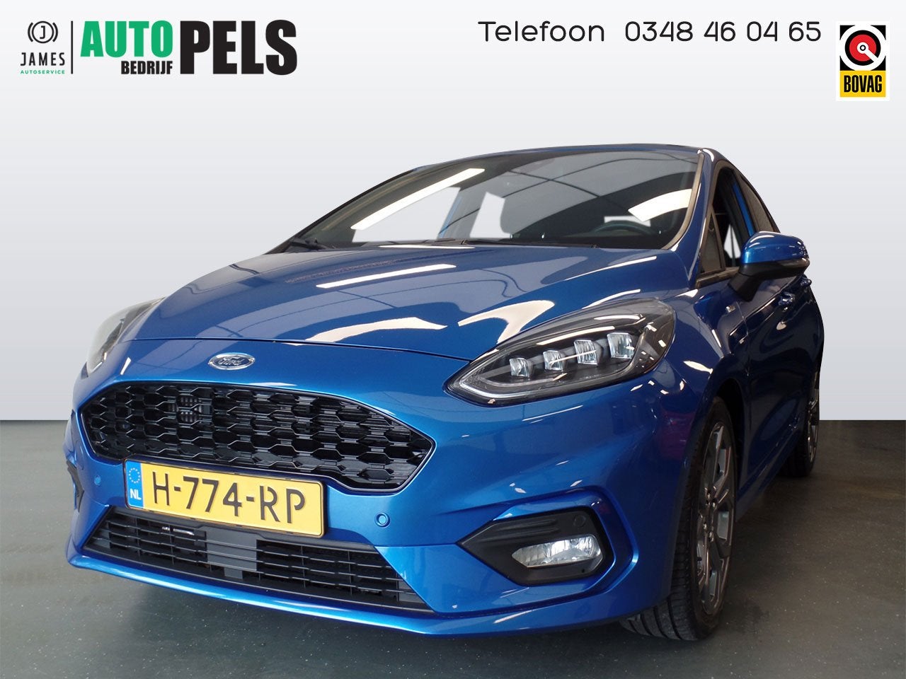 Ford Fiesta 1.0 EcoBoost ST-Line 5drs, Navigatie, Achteruitr, Auto's, Ford, Voorwielaandrijving, 94 pk, Stof, Gebruikt