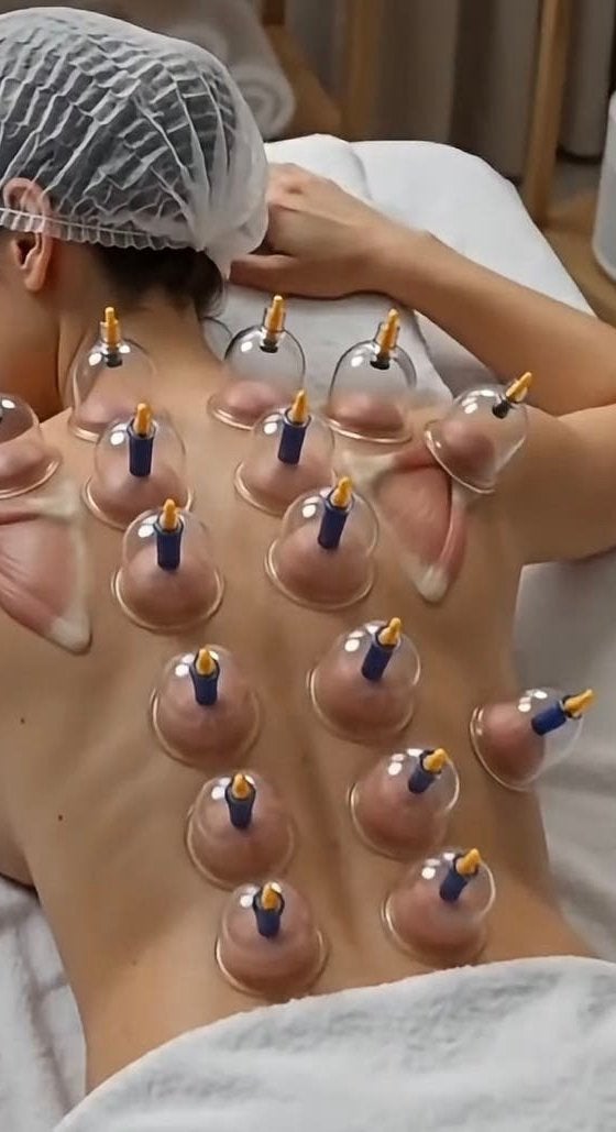 Foto 6 van Massage Therapist Relaxing & Deep Tissue Cupping Amsterdam
