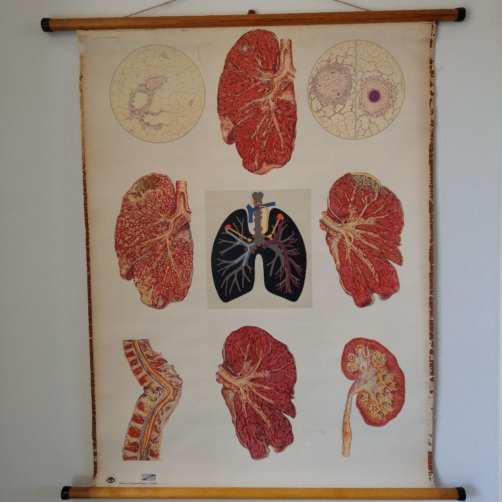 Medische schoolplaat Longen, Antiek en Kunst, Ophalen of Verzenden, Natuur en Biologie